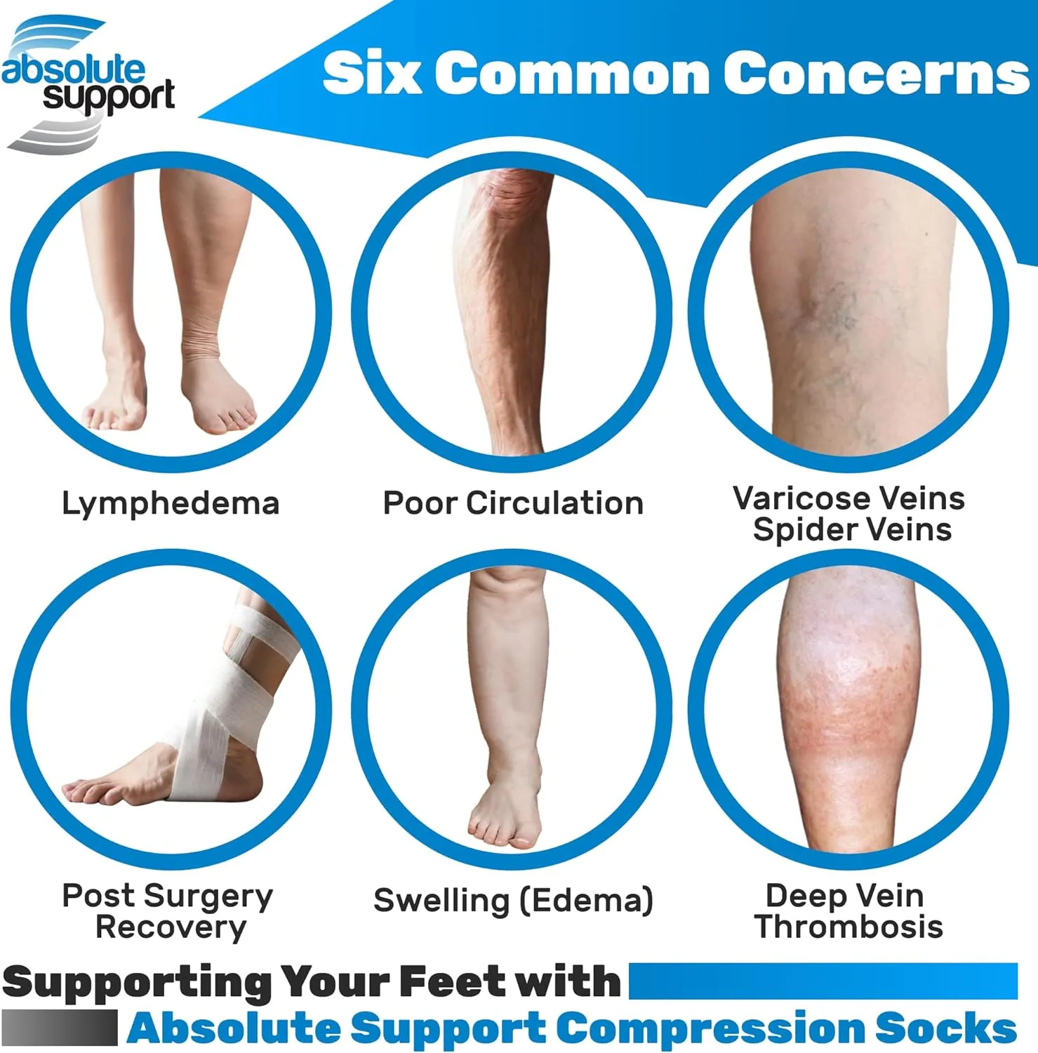 Wide Calf Compression Socks for Women 15-20mmHg with Open Toe - Graduated Sheer Compression Stockings for Sclerotherapy, Arthritis, Diabetic, DVT - Nude, 7X-Large - A111NU10